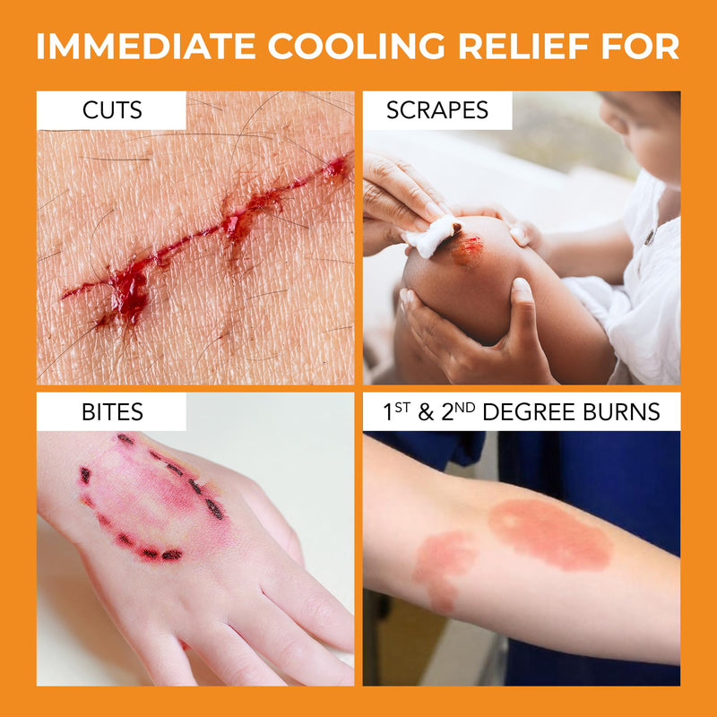 The Original Moist Burn Pad - Hydrogel Healing Pads, Soothing & Moist Skin Care Patch for Burns & Wounds, 2” x 3” Dressing 2x3