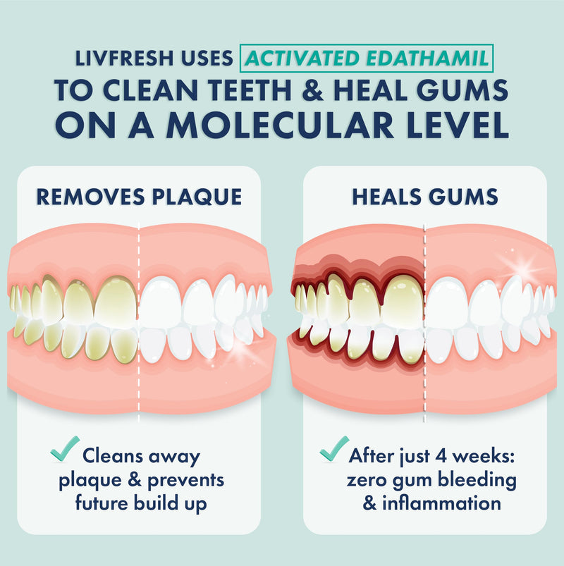 Toothpaste Gel, Clinically Proven to Remove Plaque 250% Better, Improves Gum Health 190% Better, Prevents & Reduces Tartar, Freshens Breath, SLS Free Dental Gel, Wintergreen Wintergreen, Foaming, Whitening