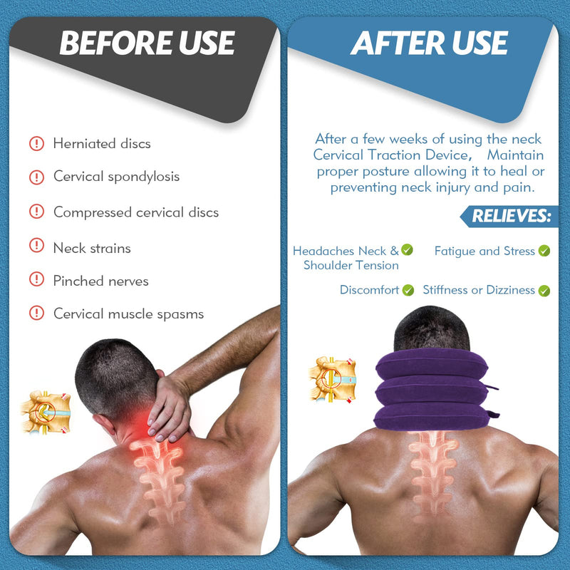 Neck Stretcher, Neck Traction Device, Cervical Traction Device, Neck Pain Relief, Adjustable Inflatable Neck Brace & Neck Stretcher Cervical Traction, Neck Decompression Home Use (Purple) Purple