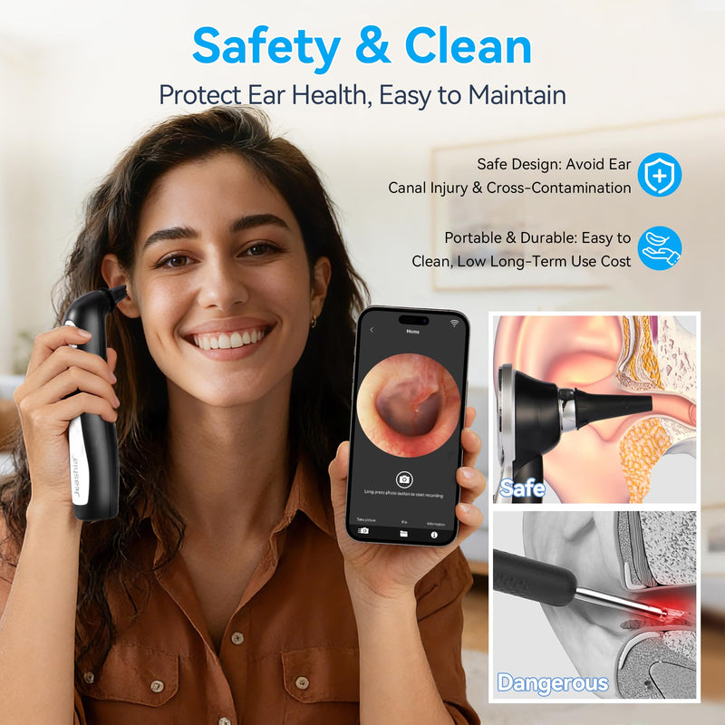 Digital Otoscope with Light, WiFi Ear Scope with 720P HD Camera, 10-Level Adjustable LED, Type-C Charging, Includes 8 Disposable Tips (4mm & 5mm)