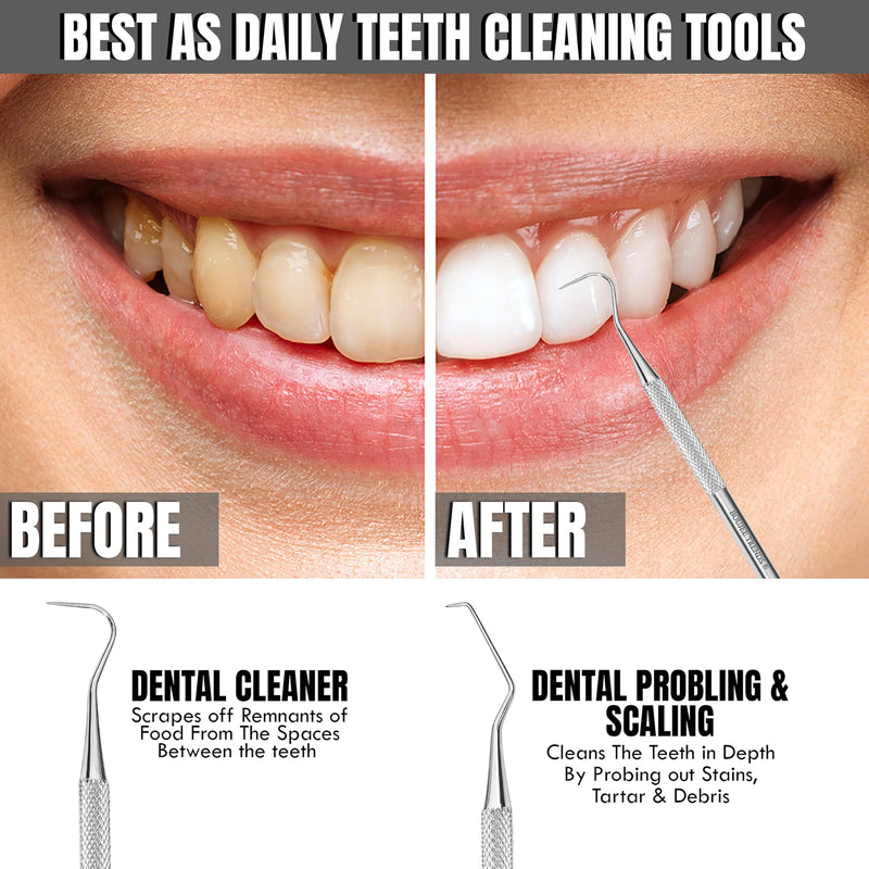 Professional Dental Tools Tartar Scraper for Dentist, Personal Use and Pets Stain Plaque Remover for Teeth, Premium Oral Care Double Ended Dental Probe Scaler | Stainless Steel