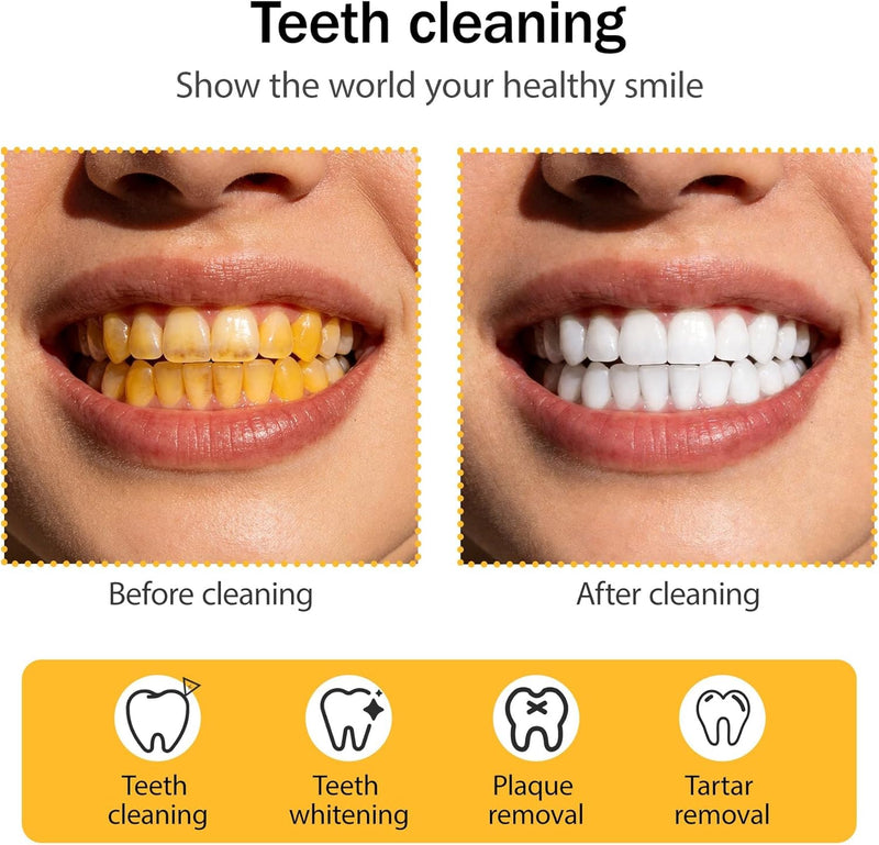 Tartar Remover Teeth Cleaning Set, 6 Dental Care Set, Dental Teeth Cleaning Kit, with Dental Probe Dental Mirror Tooth Cleaner - Teeth Cleaning Between Spaces Remove Tartar Yourself - NewNest Australia