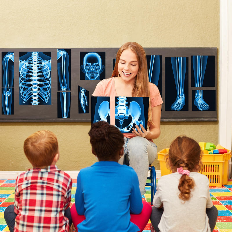 16 Pieces Human X Rays Bones X Rays Human Xrays for Kids Human Bones Body Display Play Table (Blue) Blue