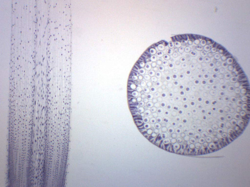 EISCO Ascaris & Onion Mitosis, Prepared Microscope Slide - 75 x 25mm - Plant & Animal Mitosis, Introductory Microscopy Single Slide