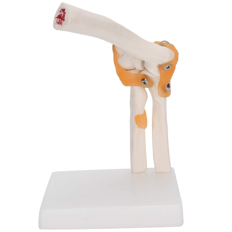 Elbow Joint Model, Elbow Joint Model Life Size Accurate Elbow Skeleton Model Boned Shoulder Joint Model for Study Display Teaching