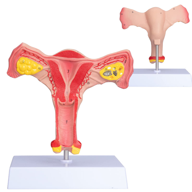 ANNWAN Female Ovary Model - Life Size Human Uterus and Ovary Model Female Reproductive Organ Model for Studying and Communication