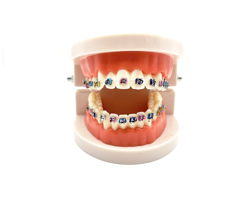 Dental Orthodontic Demonstration Model with Metal Bracket,Arch Wire Standard Teeth Model with Braces (Brackets) Brackets