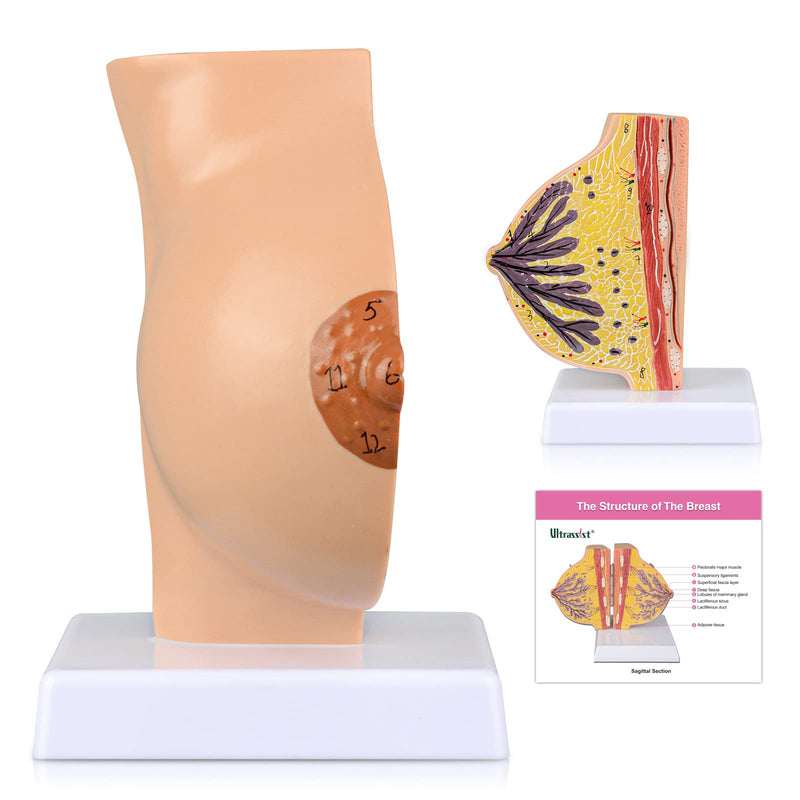 Ultrassist Non-Lactating Breast Model, Human Anatomy Model， Breast Anatomical Model with Study Card for Doctor Surgeon Gift Non-Lactating Breast Sagittal Section Model