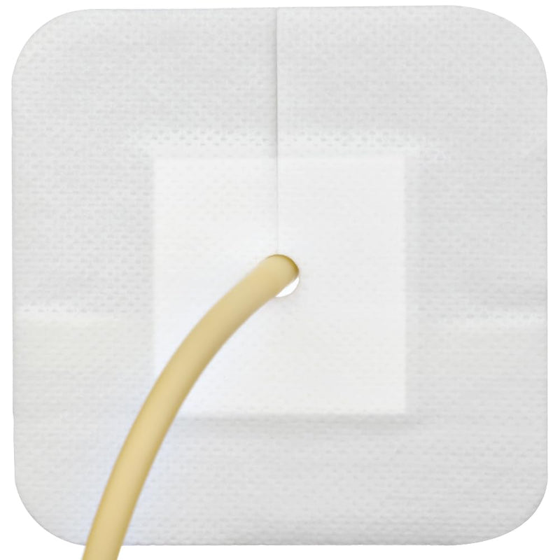 Feeding Tube Adhesive Wound Dressing Sponge Split Drain Bandage for Peg G J Supra-Pubic Incision Bordered Guaze Pad Off-Cut Catheter Stabilization Device Holder Post Surgery 4"X 4", Pack of 20 4"x4" Pack of 20