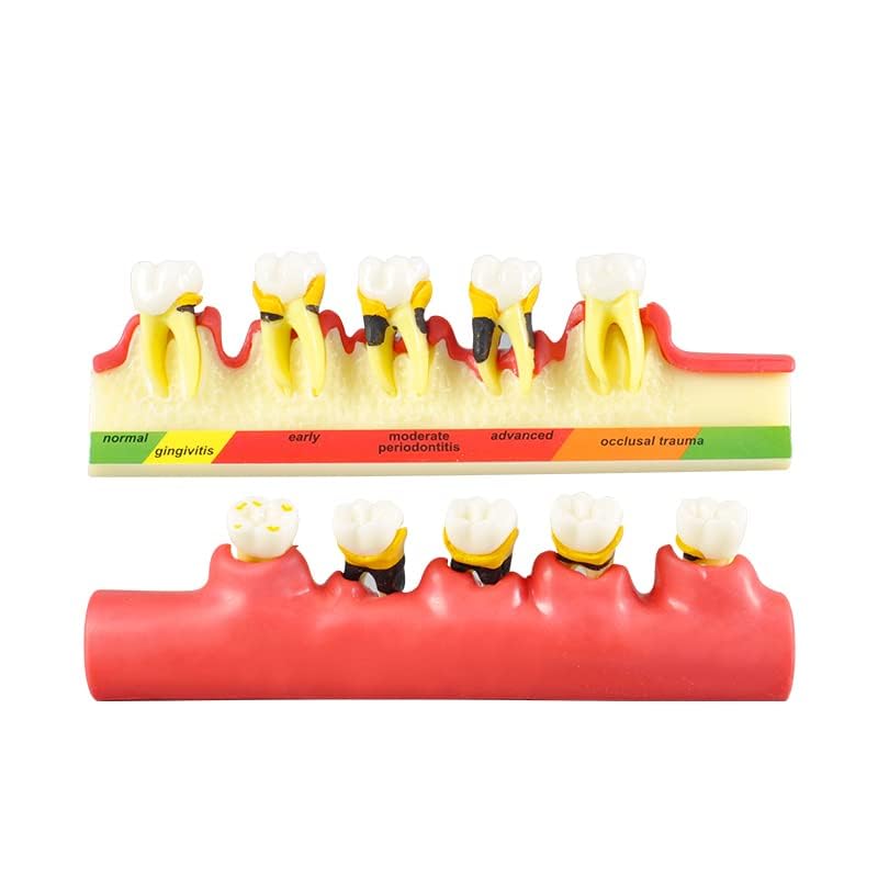 Global-Dental Model Periodontal Classification Model Periodontal Disease Model Dentist-Patient Communication Display Model