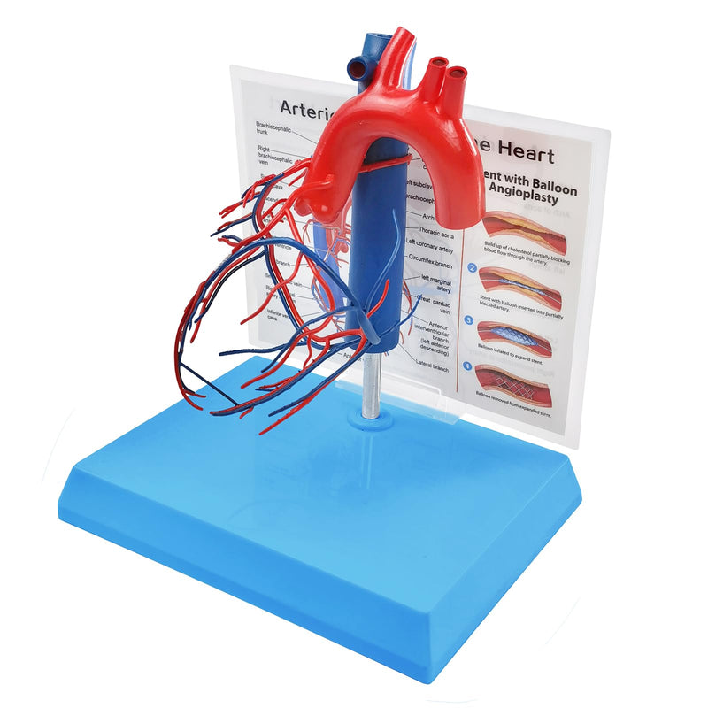NEW HORIZON Human Heart Model Vascular Heart, Naturally Size, with base Increased sized coronary anatomy depicting the cardiac veins
