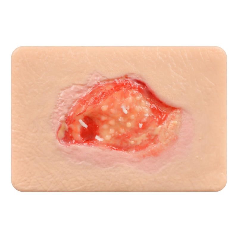 Wound Packing Trainer, Unhealthy Granulation Wound Simulation Models for Medical Education, Wound Care Demonstrations Tool