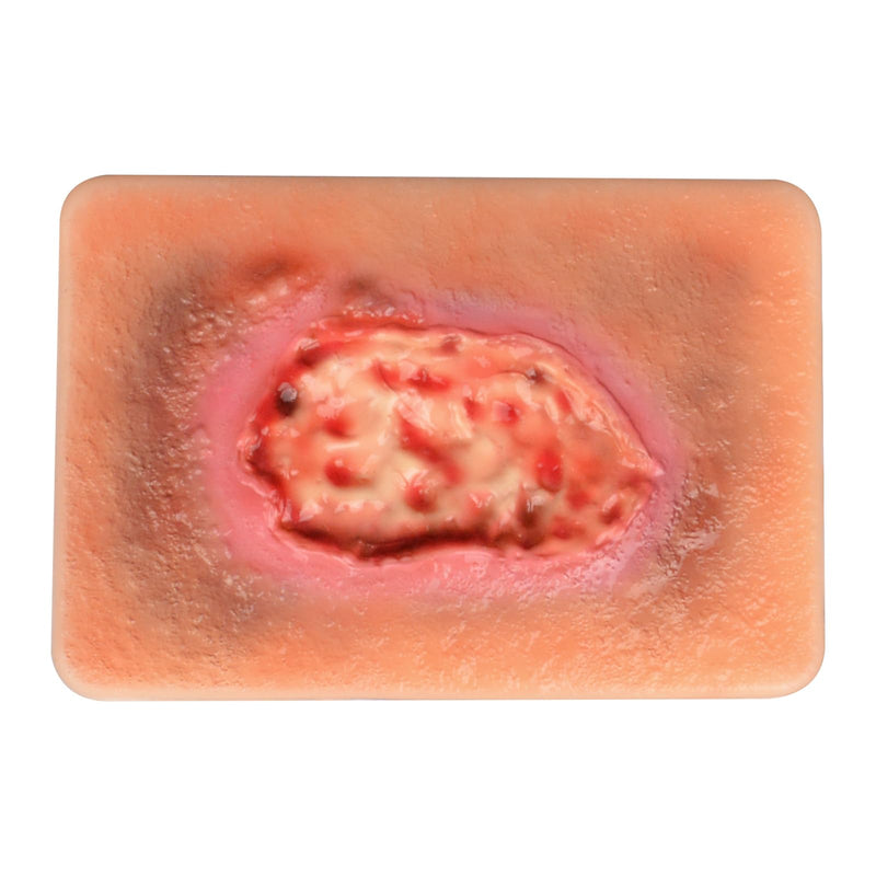 Wet Necrotic Wound Simulation Model | Wound Packing Trainer for Medical Education, Wound Care Demonstrations Tool
