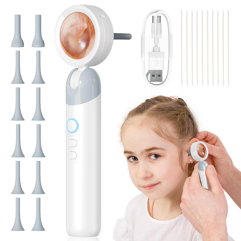 Qimic Otoscope Ear Camera with 1.38'' Screen, 1080P Ear Scope with 4 LEDs, 12 Silicone Specula Tips, Support Photo and Video, PC View, Ideal Pocket Otoscope for Adults, Kids and Pets white