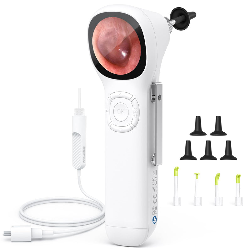 ScopeAround Digital Otoscope with IPS Screen, 720p HD Smart Visual Ear Camera, Ear Scope Otoscope Camera with 6 LED Lights, Ear Wax Removal Tool Camera, Plug & Play