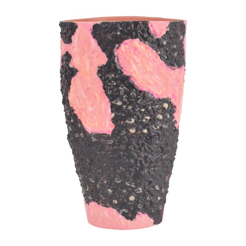 Burn Wound Packing Trainer, Burn Wound Care Model, Severe Leg Burn Wound for Demonstration