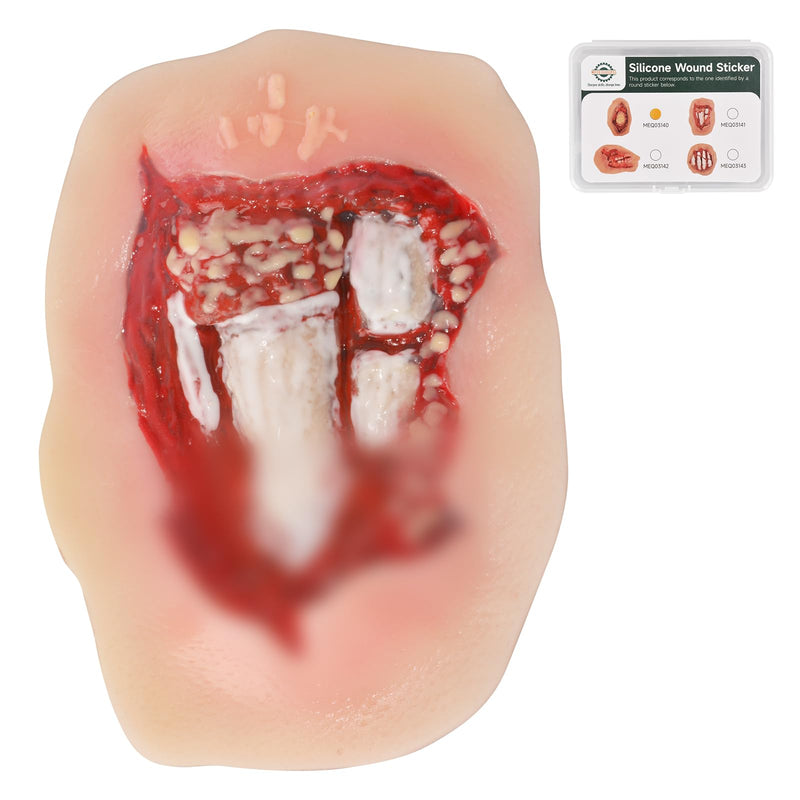 Adhesive Open Fracture Wound Model, Silicone Trauma Simulation Trainer for EMT, First Aid, Nursing & Combat Care Training