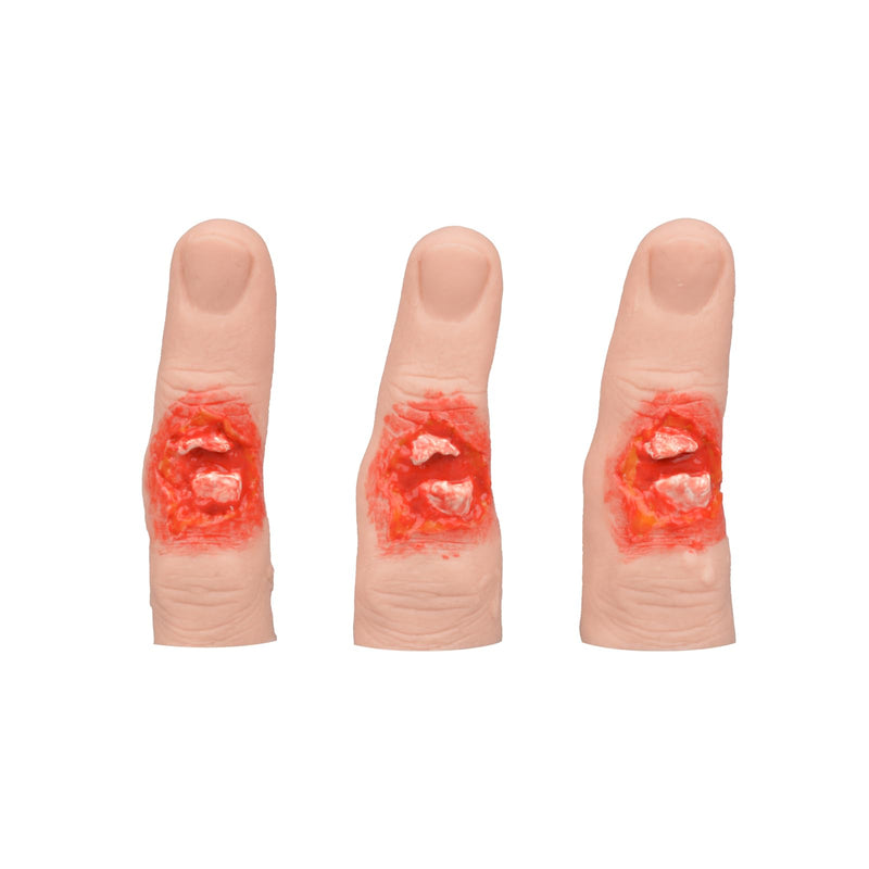 Wearable Finger Fracture Wound Trainer, Finger Injury Simulation Model with Glove, Realistic Fracture Wound Packing Trainer for First Aid & Workplace Safety Training