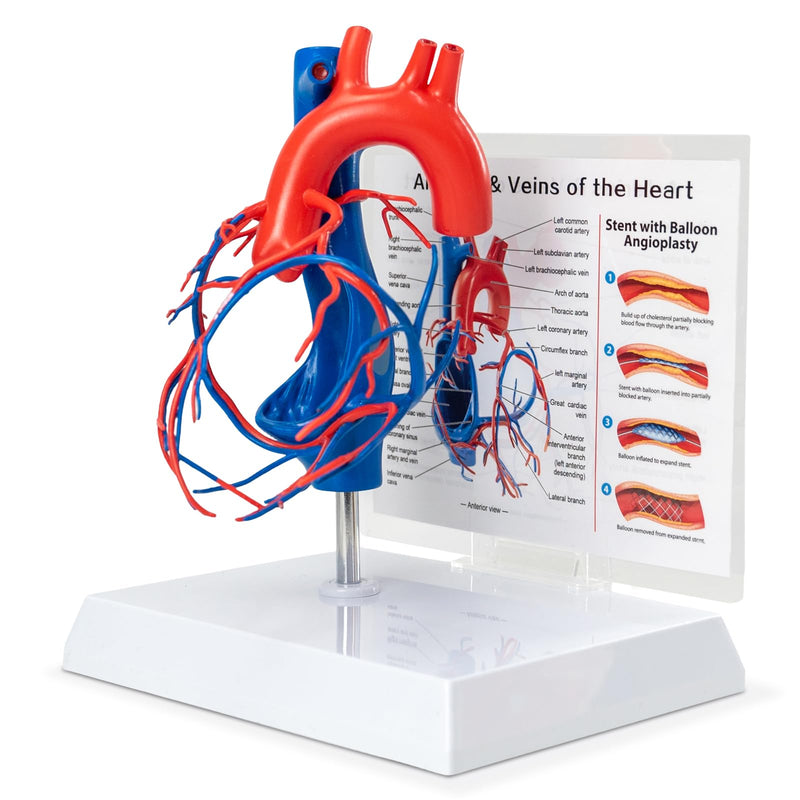 Human Heart Vascular Model, Life Size Cardiovascular Model Showing The Arteries and Veins with Base for Medical Classroom and Cardiology Study