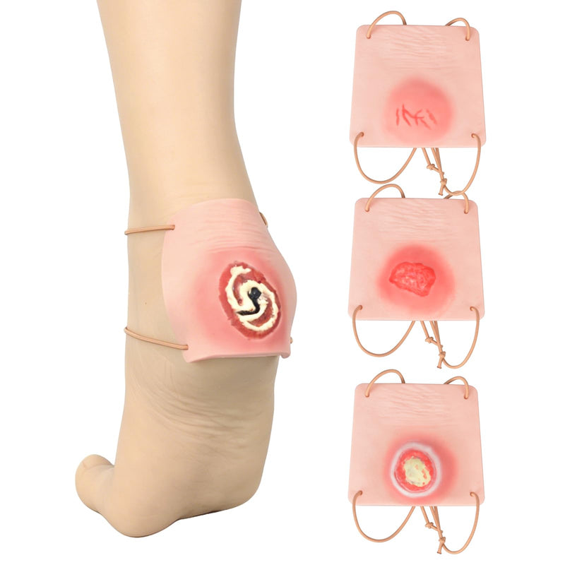 Wearable Heel Ulcer Simulation Models, 4 Stages | Pressure Injury Models, Silicone Wound Care Teaching Aid for Nursing Skills Labs, Clinical Education, Caregiver Training