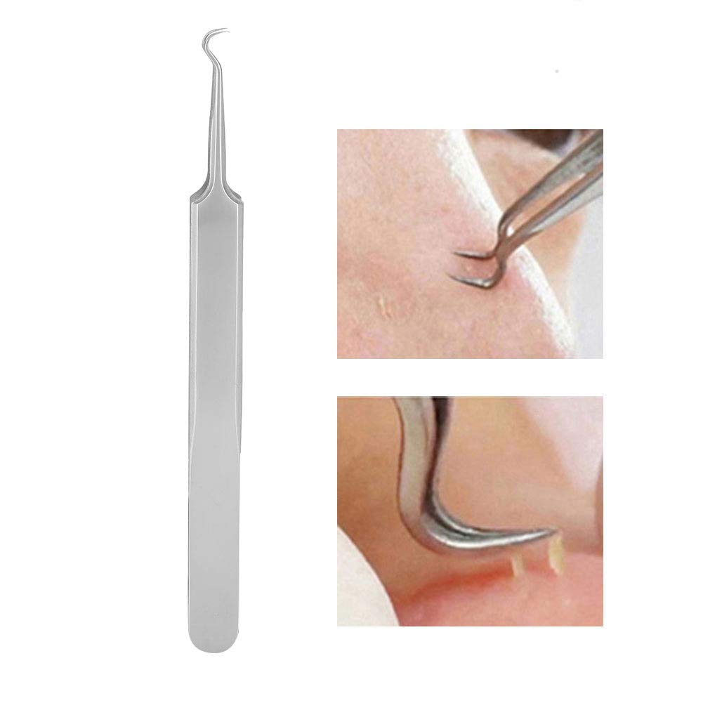 Stain Removal Tweezers, Blackhead Remover Pore Cleaner Grease Granules Tool Removal Curved Stainless Steel Blackhead Stain Granules Pimple Removal Extractor - NewNest Australia