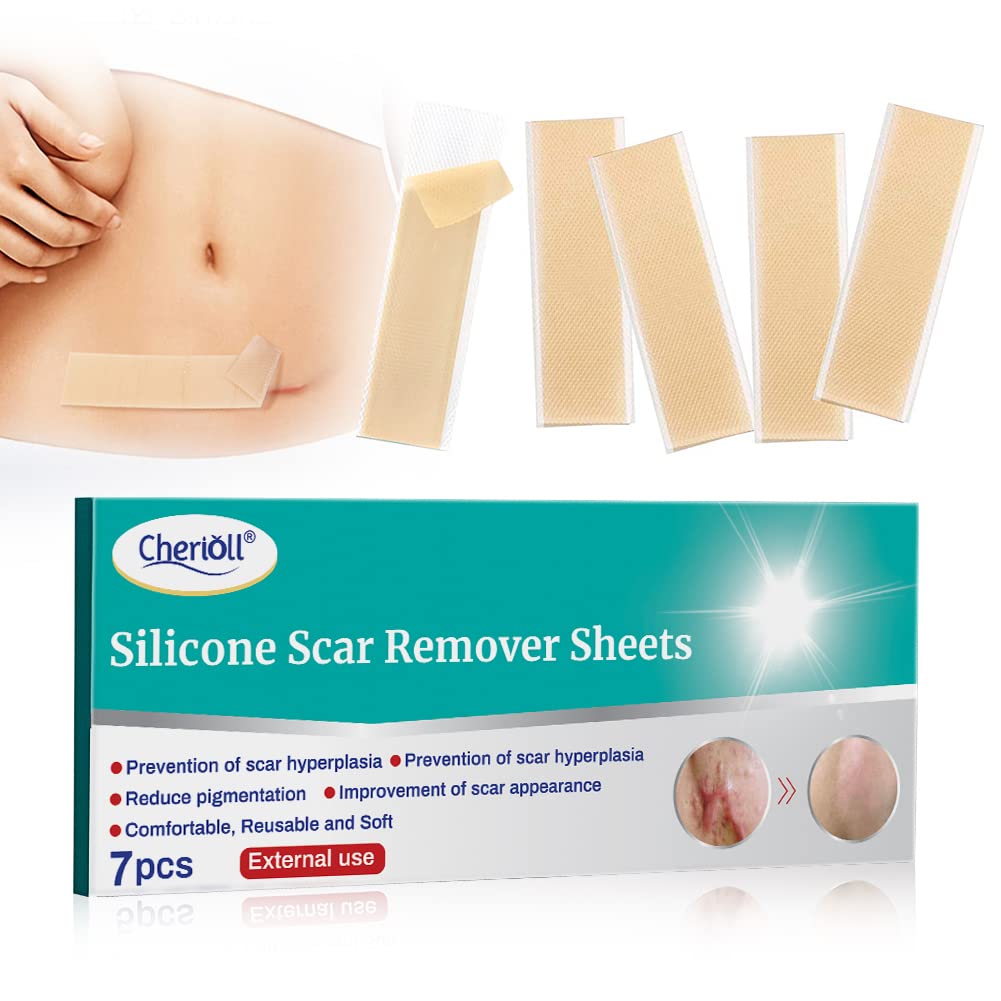 Scar Removal, Scar Treatment, Scar Cream, Scar Healing Patches Made Of Silicone Gel, Treat New And Old Scars - Acne Scars, Stretch Marks And Scars, 3.5 Cm X 15 Cm, 7 Pieces - NewNest Australia