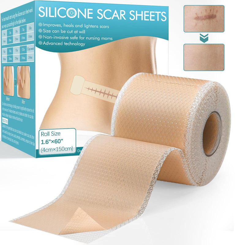 Silicone Plaster For Scars (1.6 X 60 Inch Roll - 1.5 M), Easy-Tear ...