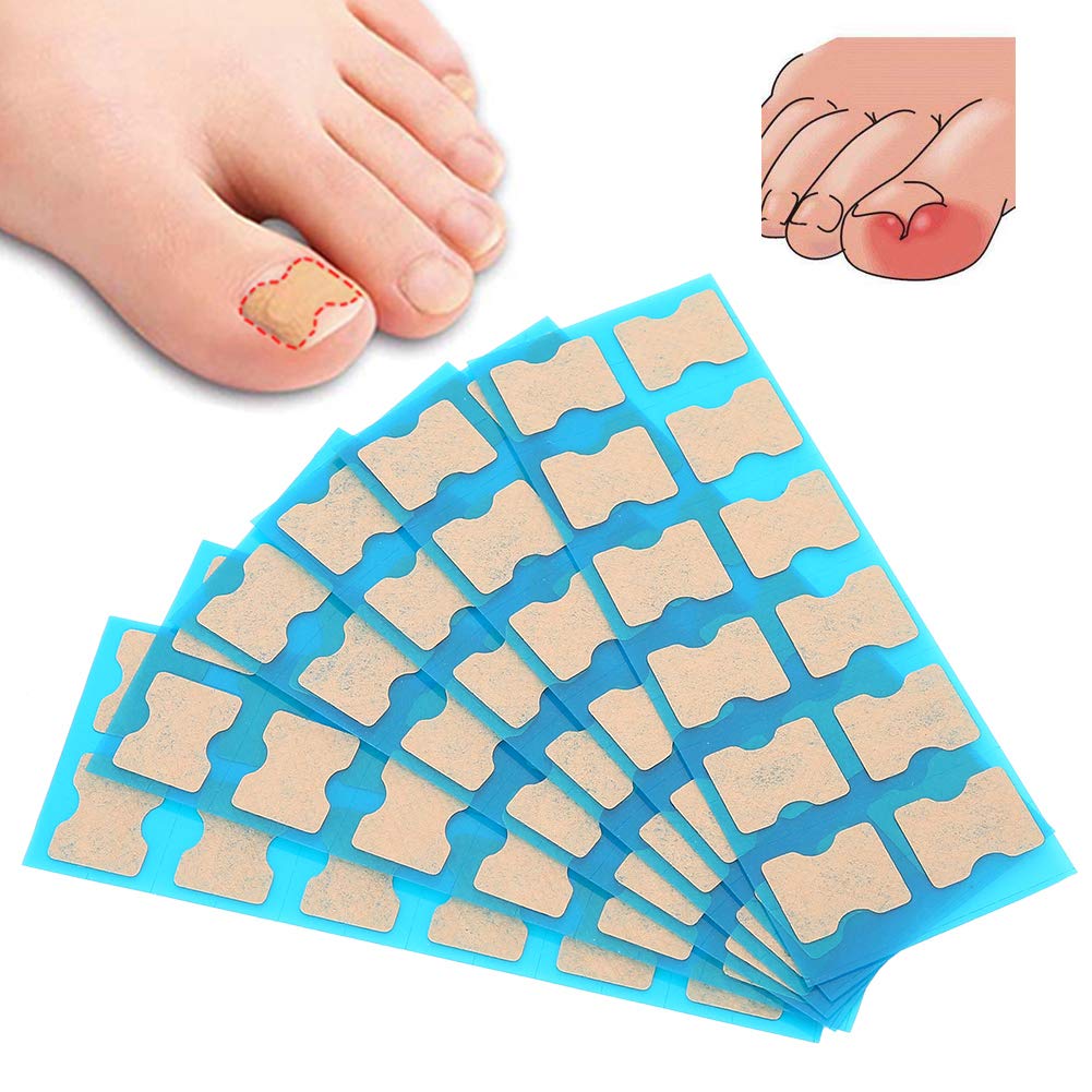 Toenail Corrector Patch, Ingrown Toenail Corrector, Toenail Correction Stickers, Ingrown Toenail Correction Patches, Foot Care Pedicure Stickers (Pack Of 72) - NewNest Australia