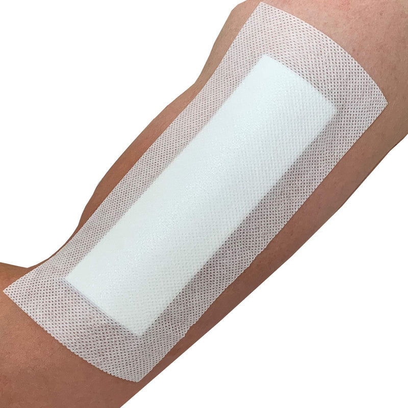 Pack of 25 Adhesive Wound Dressings - Suitable for cuts and grazes, Diabetic Leg ulcers, Venous Leg ulcers, Pressure Sores (100mmx200mm) 100mmx200mm - NewNest Australia