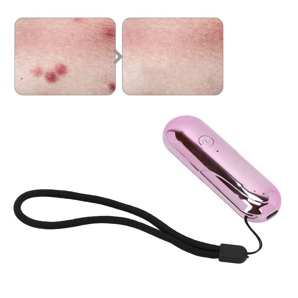 Insect Bite Relief and Healer,Bite Helper Electronic Mosquito and Insect Bite Pin USB Insect Bite Pen for The Treatment of Insect Bites and Stings Provides Natural Relief from Itching and Swelling - NewNest Australia