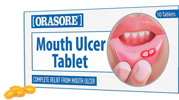 Orasore Mouth Ulcer Treatment Pastilles Tablets - 10 Count - Effective Soothing Relief from Sore Gums, Cold Sore, Sugar Free, Reduces Inflammation Due to dentures, Braces - NewNest Australia