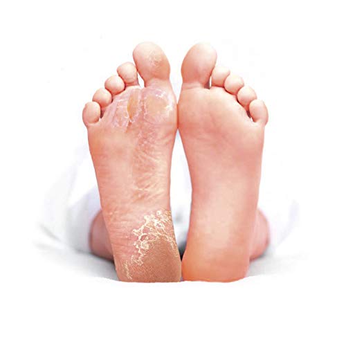 Balea Feel Well callus remover socks, 1 pair (1 x 2 pieces) callus socks, callus removal socks - NewNest Australia