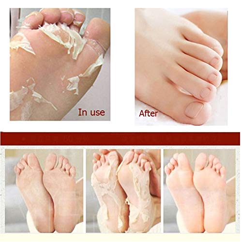 Balea Feel Well callus remover socks, 1 pair (1 x 2 pieces) callus socks, callus removal socks - NewNest Australia
