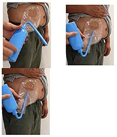 Colostomy Bag Cleaning Tool - Stoma Bag Washing Bottle Rinse Pot for All Ostomy Bags - Reusable Wash Bottle (1PCS PZ) 1 Count (Pack of 1) - NewNest Australia