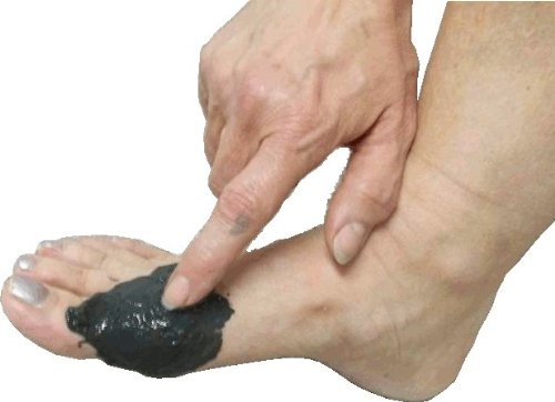 SIVASH healing clay medical product for external use, ready to use, 1kg. Healing mud for joints: rheumatism, arthrosis, arthritis, gout, ganglion (leg); Skin: acne, psoriasis, neurodermatitis - NewNest Australia