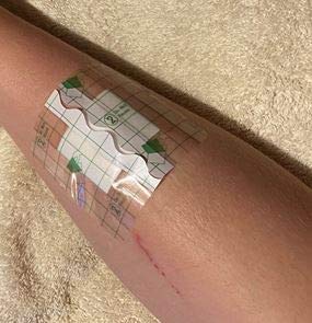 Sterile Self Adhesive Waterproof Island Dressing Latex Free with Transparent Border and 100% Cotton Absorbent pad x 25 (6cm x 7cm x 25) 6cm x 7cm x 25 - NewNest Australia