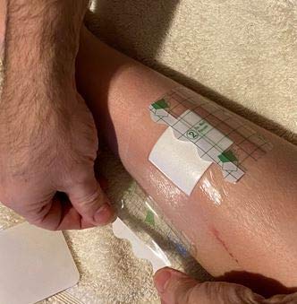 Sterile Self Adhesive Waterproof Island Dressing Latex Free with Transparent Border and 100% Cotton Absorbent pad x 25 (6cm x 7cm x 25) 6cm x 7cm x 25 - NewNest Australia