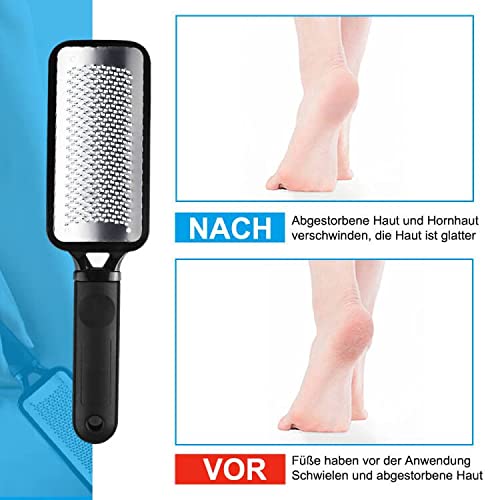 WUJUN 2Pcs Foot Files Foot Pedicure Kit, Stainless Steel Foot Rasp and Dual Sided Foot File Hard Skin Remover Professional Foot Care Tool Both Wet and Dry Cracked Feet - NewNest Australia