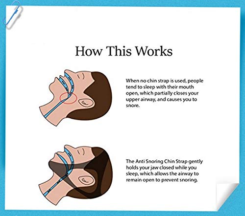 Futheda Anti Snoring Chin Strap Stop Snoring Chin Strap Comfortable Snoring Reduction Relief Better Breath and Sleep Snore Stopper Adjustable Stop Snoring Sleep Aid for Men Women - NewNest Australia