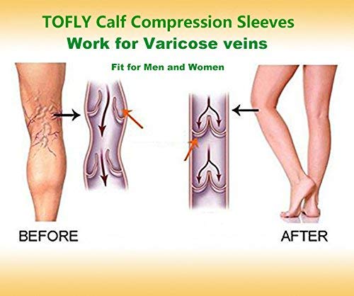 TOFLY® Calf Compression Sleeve for Men & Women, 1 Pair, Footless Compression Socks 20-30mmHg for Leg Support, Shin Splint, Pain Relief, Swelling, Varicose Veins, Maternity, Nursing, Travel, Beige XL - NewNest Australia