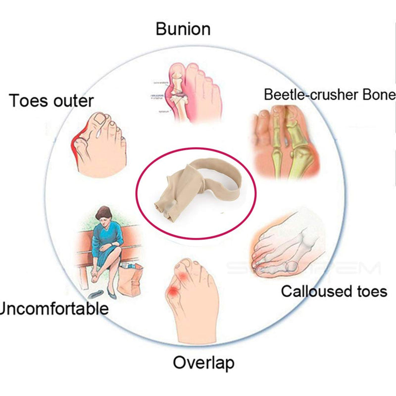 Bunion Straightener Protector Relief Sleeve w/Gel Bunion Stretchy Pads Cushioned Splint, Orthopedic Hallux Valgus Overlapping Corrector Bootie Guard Hammer Toe Pain Aid Surgery Treatment 2 Pc (L) L (Pack of 2) - NewNest Australia