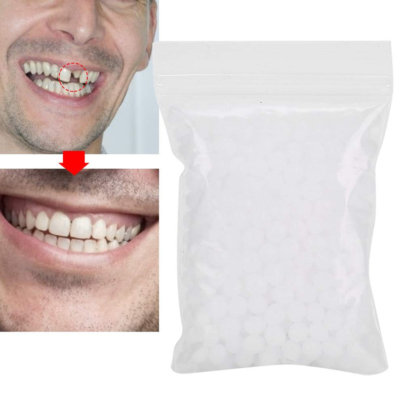 Temporary Dental Repair Beads, Multifunctional Veneers Teeth Temporary Crown For Missing Tooth Filling Material With Broken Teeth Temporary Dental Repair Kit - NewNest Australia