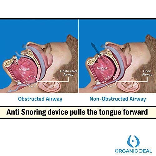 Anti Snore Devices Tongue Retainer - Sleep Aid to Breathe Rigth and Eliminate Snoring! - Sleep Well W/This Mouth Guard More Effective Than Nasal Strips Or Spray! - Snoring Aids for Men & Women - NewNest Australia