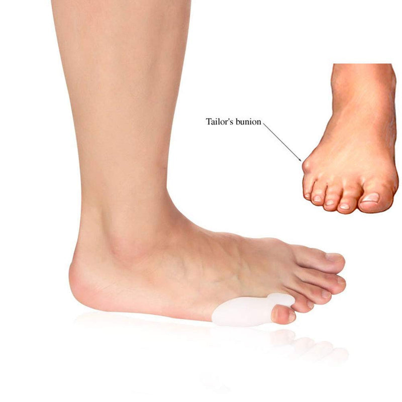 Tailor's Bunion Corrector by Pedimend - Small Toe Separators/Stretchers - Bunion Pain Relief - Prevent Corns/Callus - Pinky Toe Alignment - for Women & Men - Foot Care - NewNest Australia