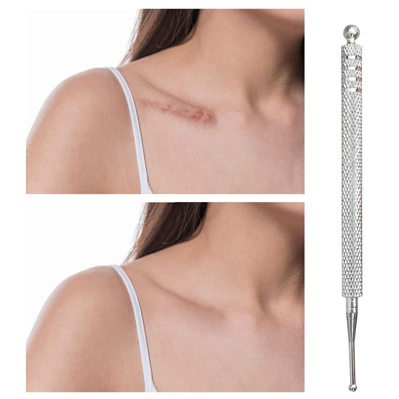 Acupressure Pen, Meridian Pen, Acupressure Rod, Acupressure Pen, Massage Pen, Acupuncture Sticks, Scar Care, Stainless Steel, Length 10 Cm, Ball Diameter 2/5 Mm - NewNest Australia