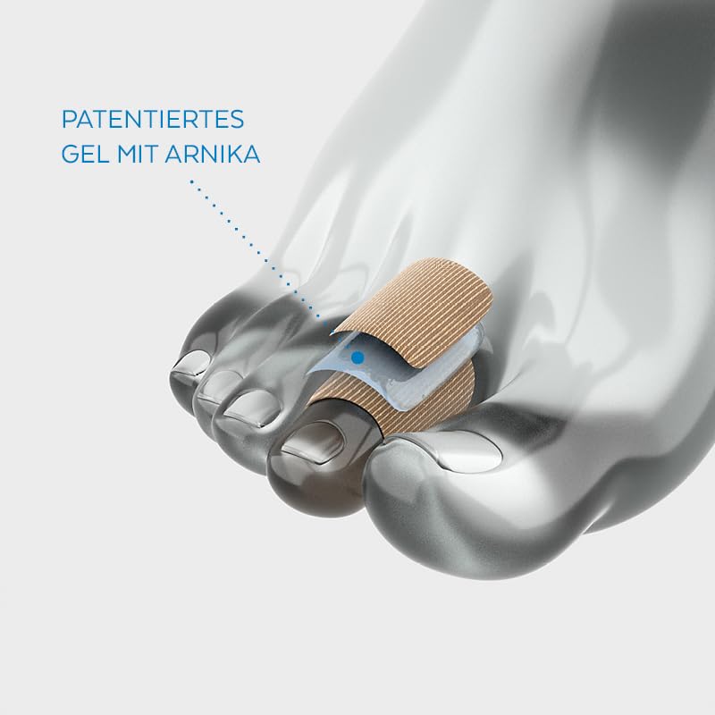 PODERM - TOE PROTECTION CHICKEN EYE/CALLUS GEL ARNICA PATENTED - Instantly relieves pain - Prevents calluses from forming - 100% natural active ingredients - Proven effectiveness - Swiss Lab size S - NewNest Australia