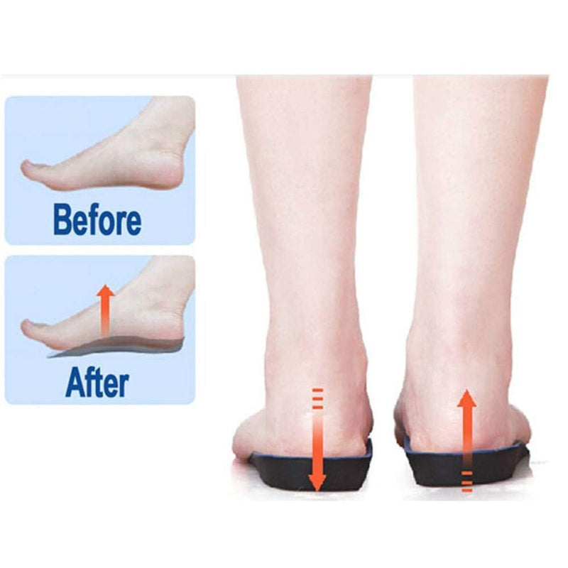 Orthotic Insole Arch Support Insoles Orthotic Inserts 3/4 Length Flat Feet Insoles Shoe Inserts Comfort Cushioning for Men Women Over-Pronation,Plantar Fasciitis, Heel Pain (S 5-6.5) S 5-6.5 - NewNest Australia
