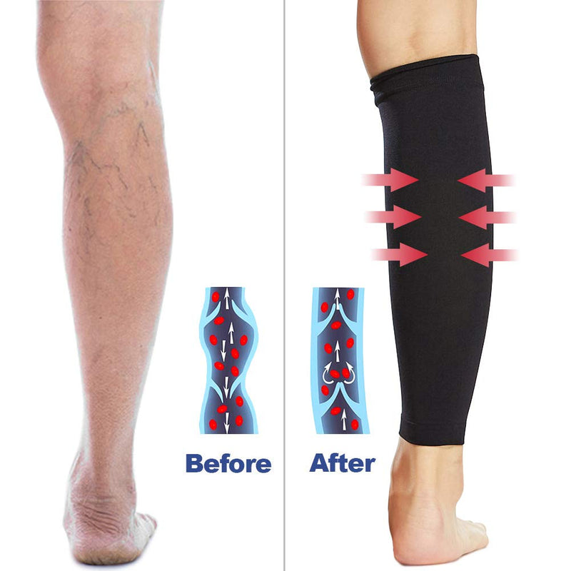 Beister Waden Medical Compression Stockings For Men And Women Varicose Veins Medical Thrombosis Stockings Protection With 20-30 Mmhg Class 2 Gradient Compression, Black - NewNest Australia