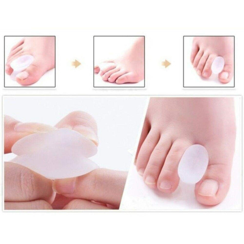 Gel Toe Caps, Hallux Valgus Toe Separator, Silicone Toe Protection, Toe Separator, Toe Corrector Spacers For Overlapping Toes, Soft And Comfortable, Pack Of 4 - NewNest Australia