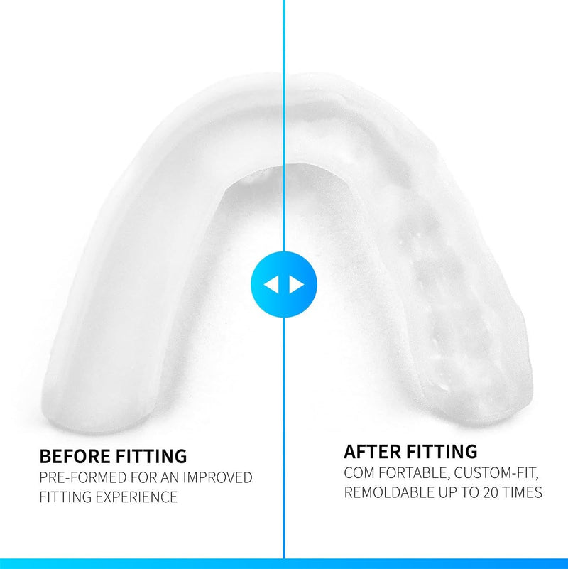 SOVA 3D bite splint - 1.6 mm thin - tailor-made fit - protects against night-time teeth grinding and clenching - odorless and taste-free - can be reshaped up to 20 times - non-toxic - NewNest Australia